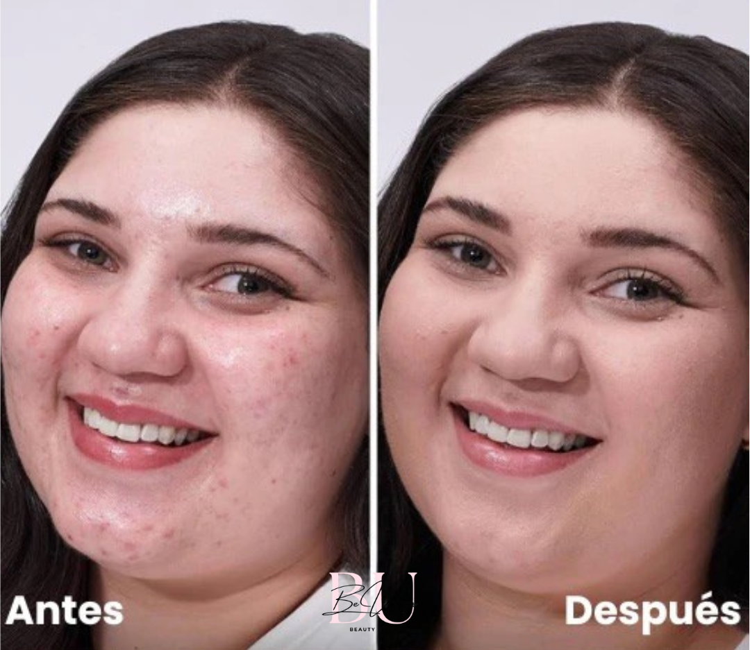 Base De Maquillaje Correctora Mushroom TUZ ¡Piel Perfecta al Instante!