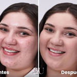 Base De Maquillaje Correctora Mushroom TUZ ¡Piel Perfecta al Instante!